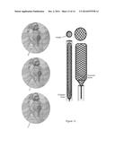 NON-BLOOD CONTACTING MECHANICAL DEVICE THAT IMPROVES HEART FUNCTION AFTER     INJURY diagram and image