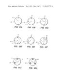 METHODS AND DEVICES FOR CONTROLLING A SHAPEABLE MEDICAL DEVICE diagram and image