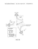 METHODS AND DEVICES FOR CONTROLLING A SHAPEABLE MEDICAL DEVICE diagram and image