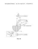 METHODS AND DEVICES FOR CONTROLLING A SHAPEABLE MEDICAL DEVICE diagram and image