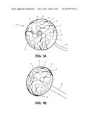 CARDIAC ABLATION CATHETERS AND METHODS OF USE THEREOF diagram and image