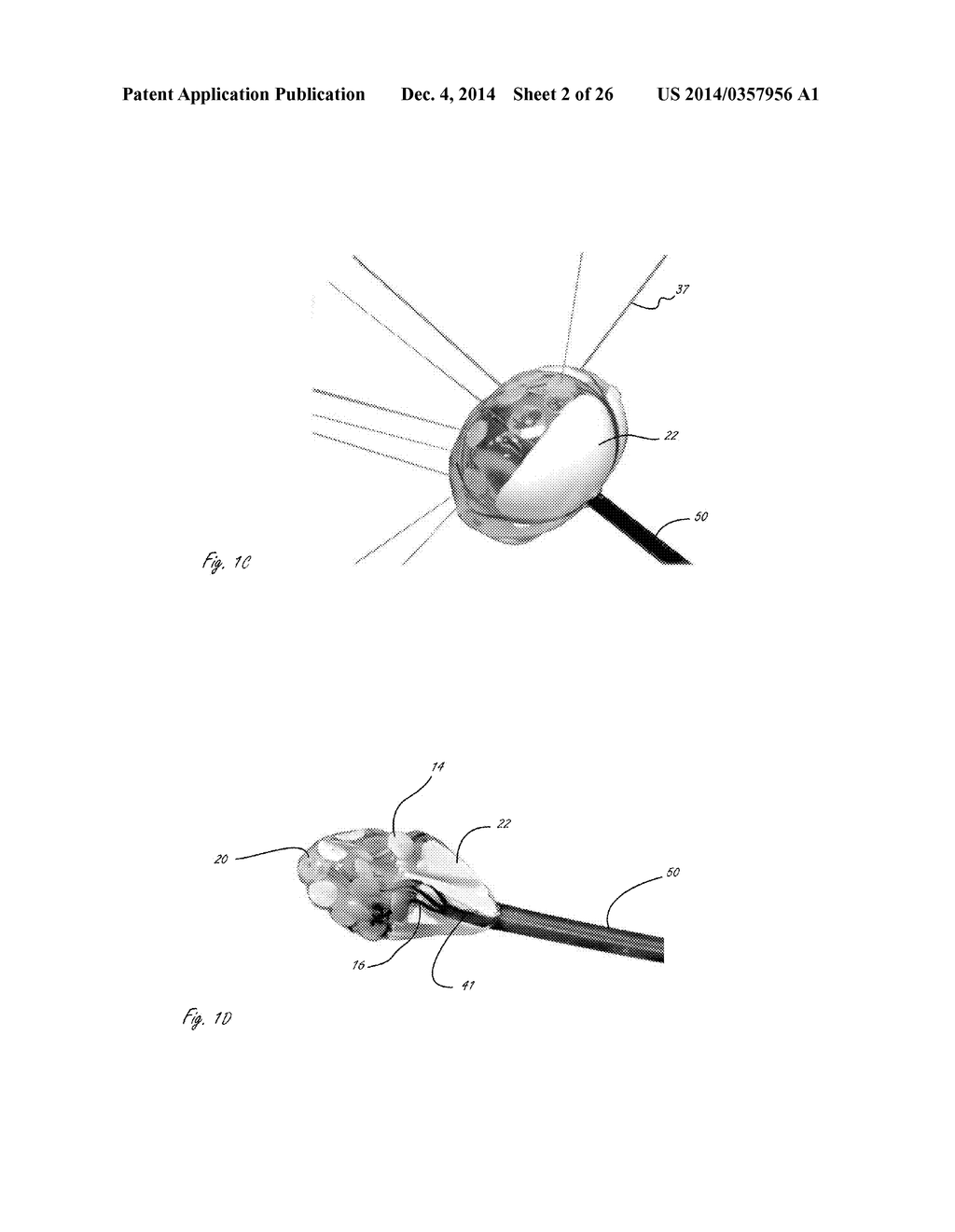 CARDIAC ABLATION CATHETERS AND METHODS OF USE THEREOF - diagram, schematic, and image 03