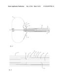 CARDIAC ABLATION CATHETERS AND METHODS OF USE THEREOF diagram and image