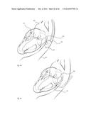 CARDIAC ABLATION CATHETERS AND METHODS OF USE THEREOF diagram and image
