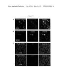 Systems, Methods and Compositions for Optical Stimulation of Target Cells diagram and image