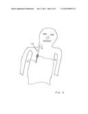 Tunneled Catheter with Hemostasis Mechanism diagram and image