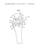 ABSORBENT ARTICLES AND METHODS OF MANUFACTURING THE SAME diagram and image