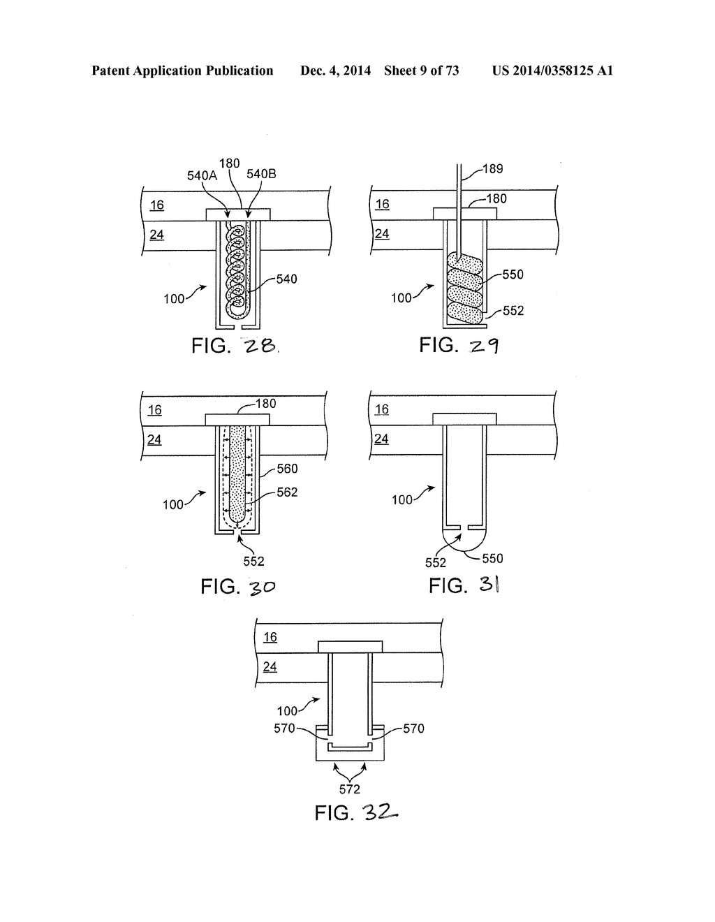 SMALL MOLECULE DELIVERY WITH IMPLANTABLE THERAPEUTIC DEVICE - diagram, schematic, and image 10