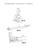 ADAPTER LOAD BUTTON DECOUPLED FROM LOADING UNIT SENSOR diagram and image