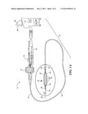 ADJUSTABLE CATHETER FOR OSTIAL, SEPTAL, AND ROOF ABLATION IN ATRIAL     FIBRILLATION PATIENTS diagram and image