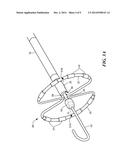 ADJUSTABLE CATHETER FOR OSTIAL, SEPTAL, AND ROOF ABLATION IN ATRIAL     FIBRILLATION PATIENTS diagram and image