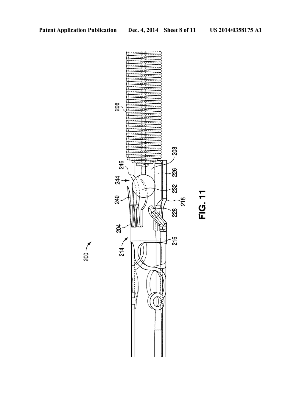 EMBOLIC COIL IMPLANT SYSTEM AND IMPLANTATION METHOD - diagram, schematic, and image 09