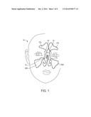 DEVICES AND METHODS FOR INSERTING A SINUS DILATOR diagram and image