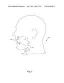 Device and Method for Snoring Detection and Control diagram and image