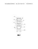 STENT GRAFT diagram and image