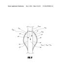 STENT GRAFT diagram and image