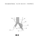 STENT GRAFT diagram and image