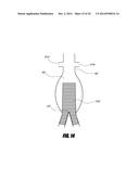 STENT GRAFT diagram and image