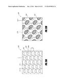 STENT GRAFT diagram and image