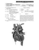 PLATFORMS FOR MITRAL VALVE REPLACEMENT diagram and image