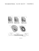 PLATFORMS FOR MITRAL VALVE REPLACEMENT diagram and image