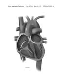 PLATFORMS FOR MITRAL VALVE REPLACEMENT diagram and image