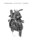 PLATFORMS FOR MITRAL VALVE REPLACEMENT diagram and image