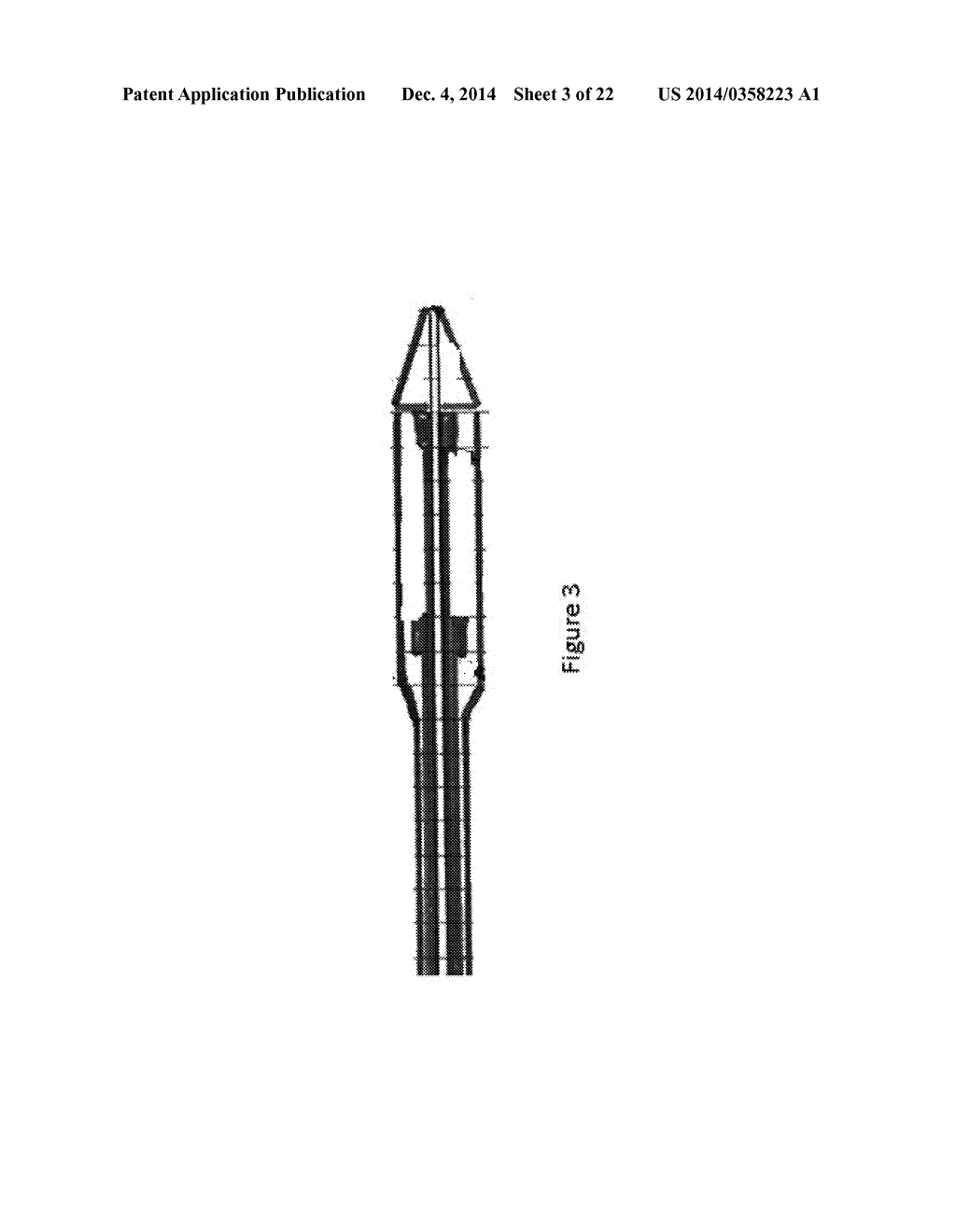 PROSTHESES - diagram, schematic, and image 04