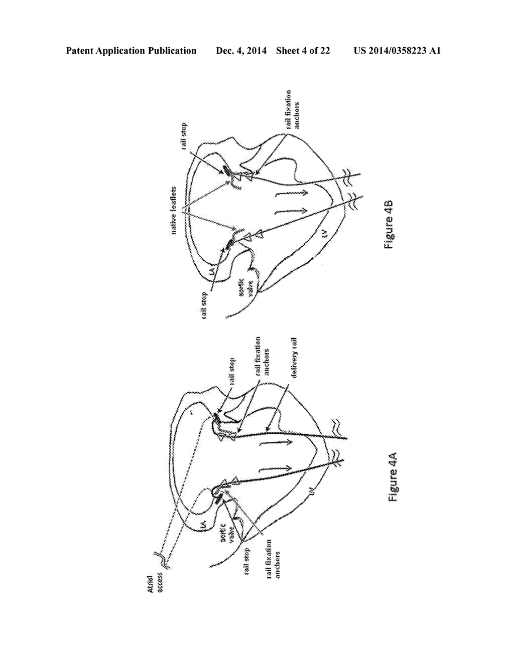 PROSTHESES - diagram, schematic, and image 05