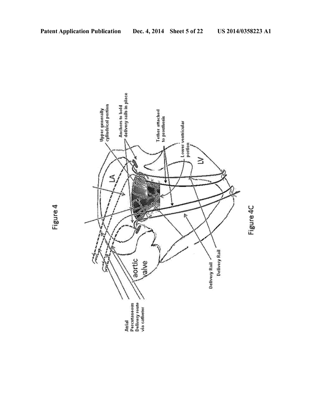 PROSTHESES - diagram, schematic, and image 06