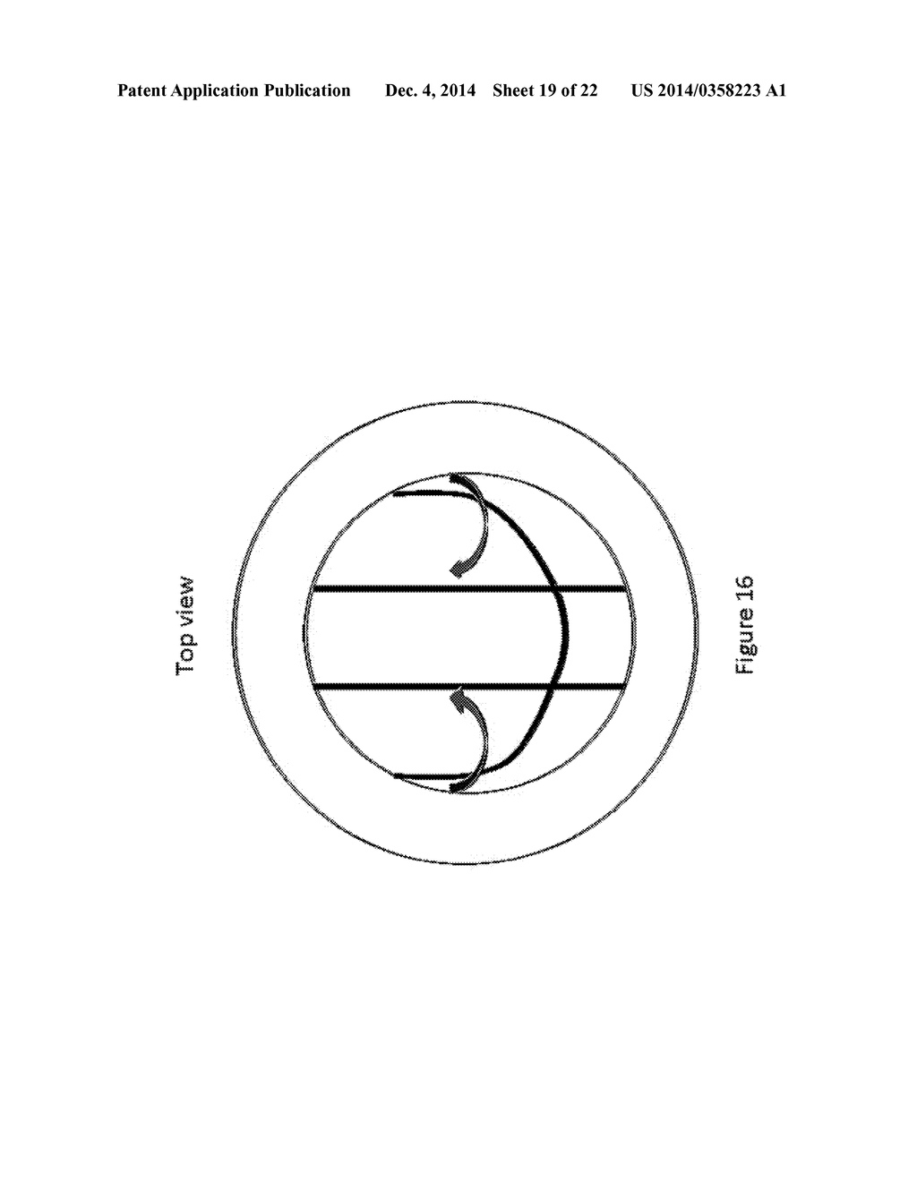 PROSTHESES - diagram, schematic, and image 20