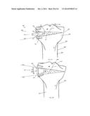 METHODS AND APPARATUS FOR AN OSTEOTOMY FIXATION OR ARTHRODESIS CAGE diagram and image