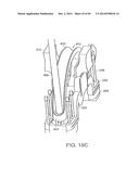 SYSTEMS, DEVICES AND APPARATUSES FOR BONY FIXATION AND DISK REPAIR AND     REPLACEMENT METHODS RELATED THERETO diagram and image