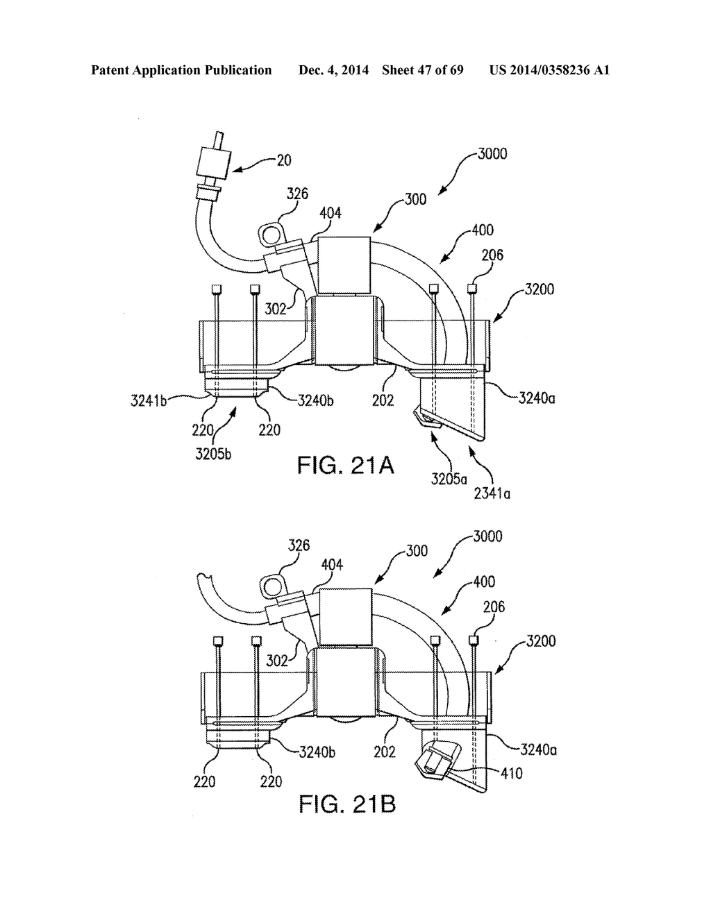 SYSTEMS, DEVICES AND APPARATUSES FOR BONY FIXATION AND DISK REPAIR AND     REPLACEMENT METHODS RELATED THERETO - diagram, schematic, and image 48