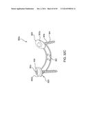 SYSTEMS, DEVICES AND APPARATUSES FOR BONY FIXATION AND DISK REPAIR AND     REPLACEMENT METHODS RELATED THERETO diagram and image