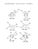 SYSTEMS, DEVICES AND APPARATUSES FOR BONY FIXATION AND DISK REPAIR AND     REPLACEMENT METHODS RELATED THERETO diagram and image