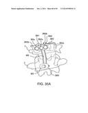 SYSTEMS, DEVICES AND APPARATUSES FOR BONY FIXATION AND DISK REPAIR AND     REPLACEMENT METHODS RELATED THERETO diagram and image