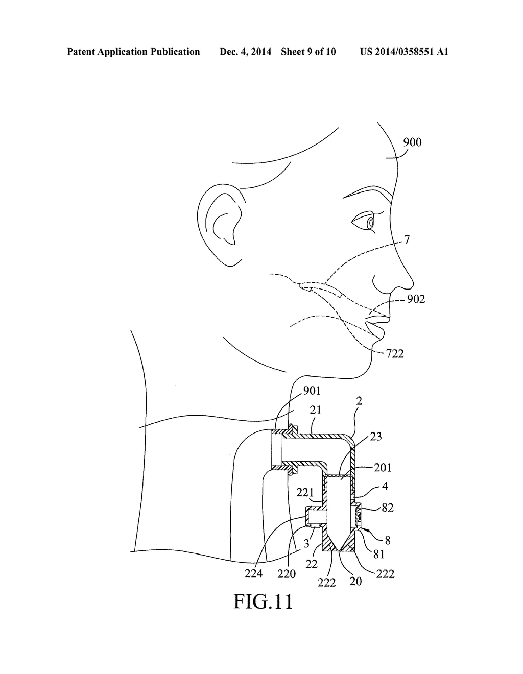 Speech Aid System - diagram, schematic, and image 10