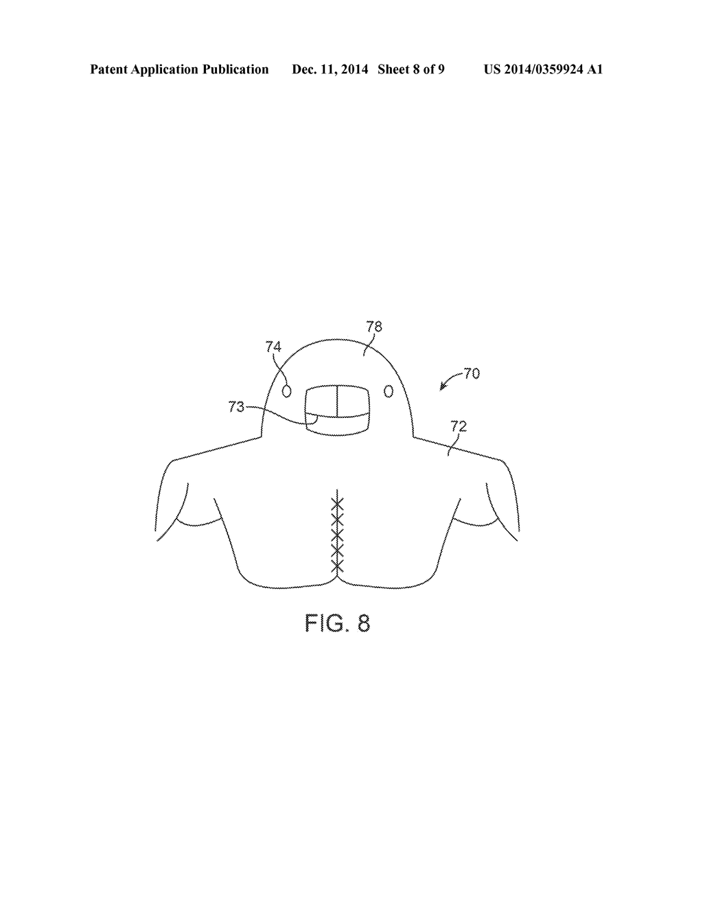 HEAD AND NECK PROTECTION APPARATUS - diagram, schematic, and image 09