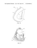 FULL-FACE MASK AND MASK CUSHION THEREFOR diagram and image