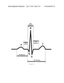 DEVICE AND METHOD FOR CONTINUOUS BIOMETRIC RECOGNITION BASED ON     ELECTROCARDIOGRAPHIC SIGNALS diagram and image