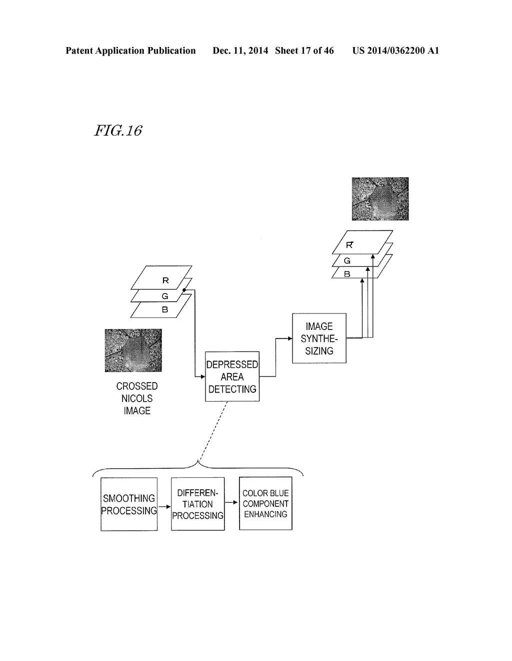 IMAGE PROCESSING APPARATUS AND ENDOSCOPE - diagram, schematic, and image 18