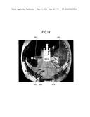 PERIPHERY-MONITORING DEVICE FOR WORKING MACHINES diagram and image