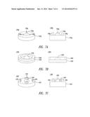 SURFACE ADHERING LENS diagram and image