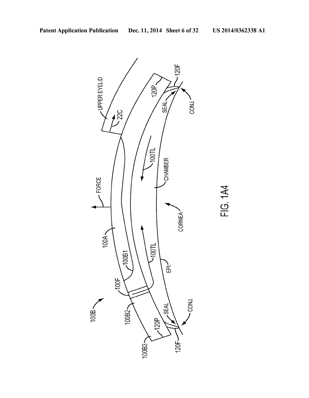 EYE COVERING AND REFRACTIVE CORRECTION METHODS AND APPARATUS HAVING     IMPROVED TEAR FLOW, COMFORT, AND/OR APPLICABILITY - diagram, schematic, and image 07