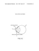 SYSTEM AND METHOD FOR DESIGNING WAVEFRONT-GUIDED OPHTHALMIC LENSES diagram and image