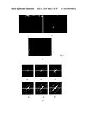 COMPUTATIONAL METHODS AND APPARATUS FOR MEIBOGRAPHY diagram and image