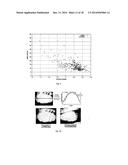 COMPUTATIONAL METHODS AND APPARATUS FOR MEIBOGRAPHY diagram and image