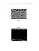 COMPUTATIONAL METHODS AND APPARATUS FOR MEIBOGRAPHY diagram and image