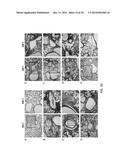 COMBINED ANTIGEN AND DNA VACCINE FOR PREVENTING AND TREATING RSV INFECTION diagram and image